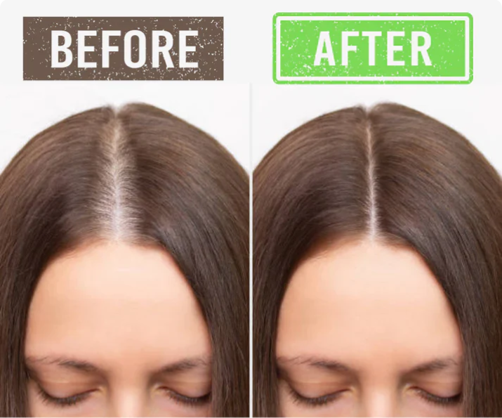 Scalp Serum